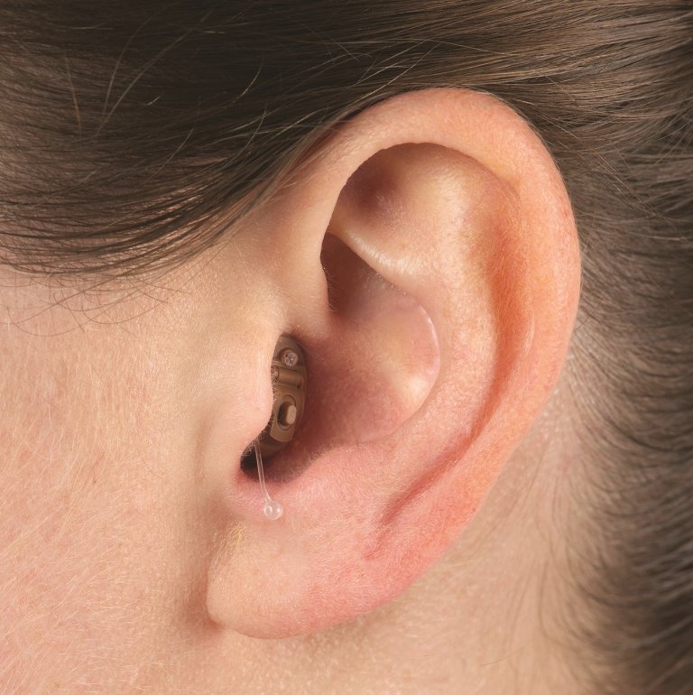 Invisible IIC Hearing Aid Example